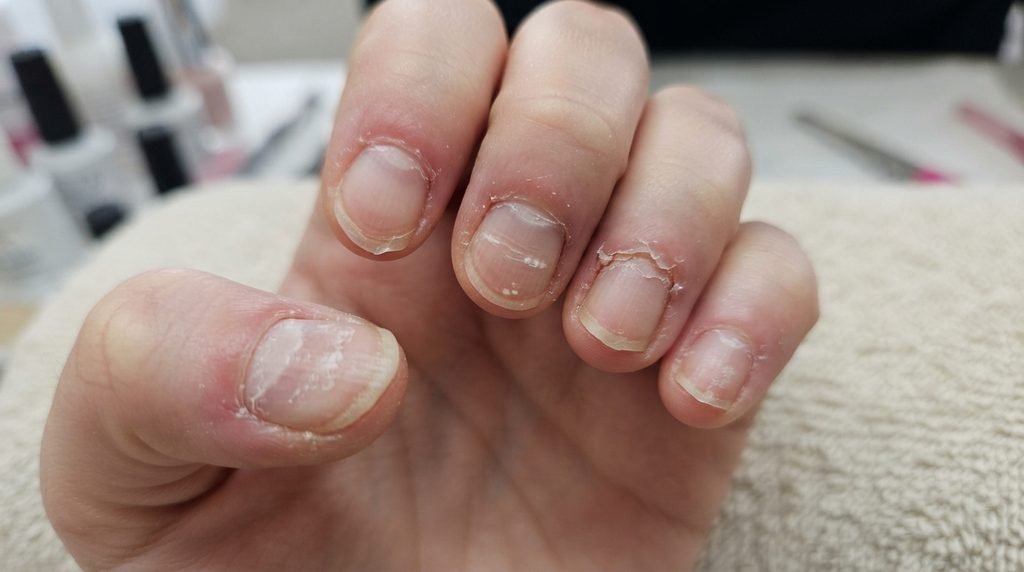 How Can BIAB Damage Your Natural Nails?